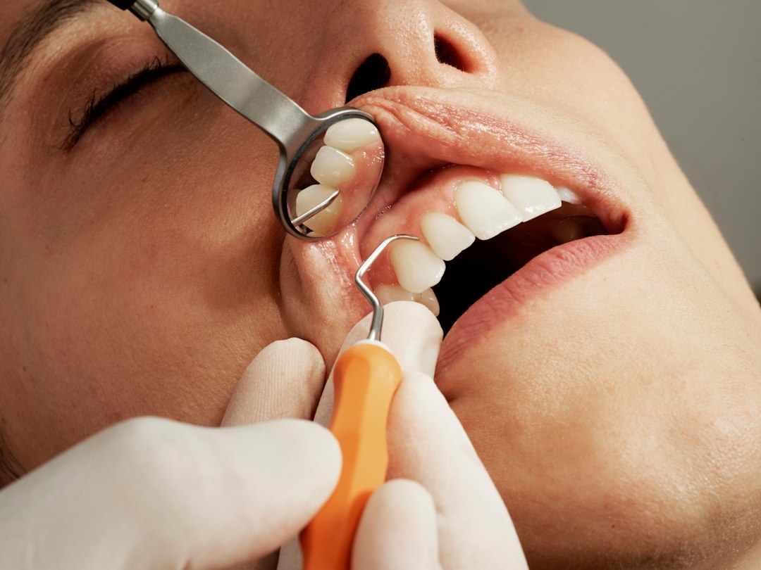 How Oral Thrush and Candida Overgrowth Happen in Your Mouth